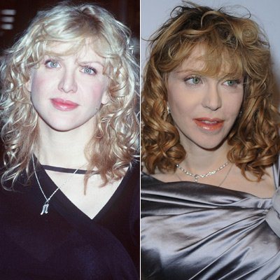 Courtney Love: Vorher-Nachher
