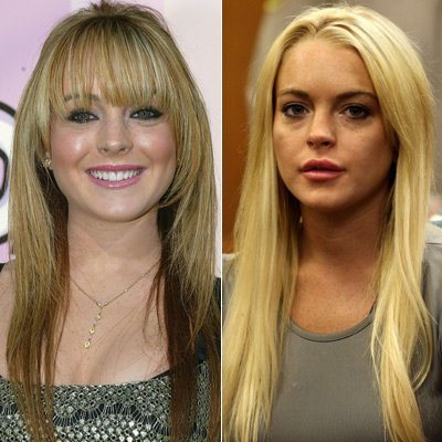 Lindsay Lohan: Vorher-Nachher