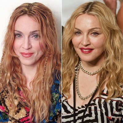 Madonna: Vorher-Nachher