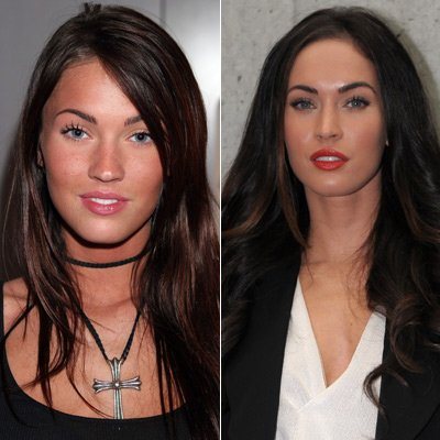 Megan Fox operiert?