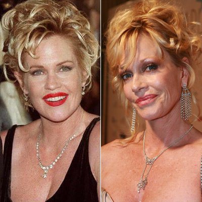 Melanie Griffith: Vorher-Nachher