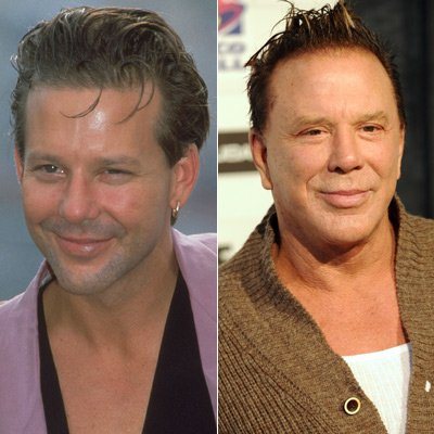 Mickey Rourke: Vorher-Nachher