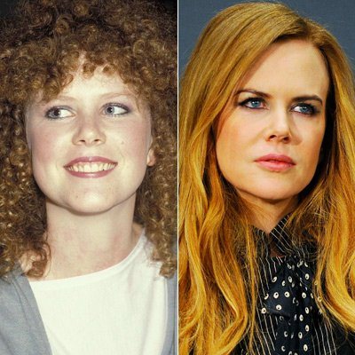 Nicole Kidman operiert?