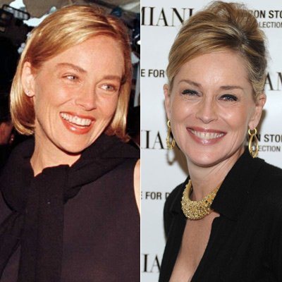 Sharon Stone: Vorher-Nachher