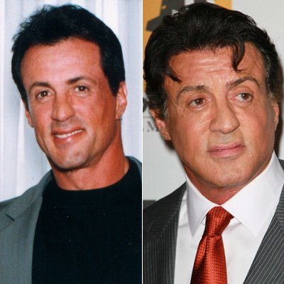 Silvester Stallone Schönheits-OP?