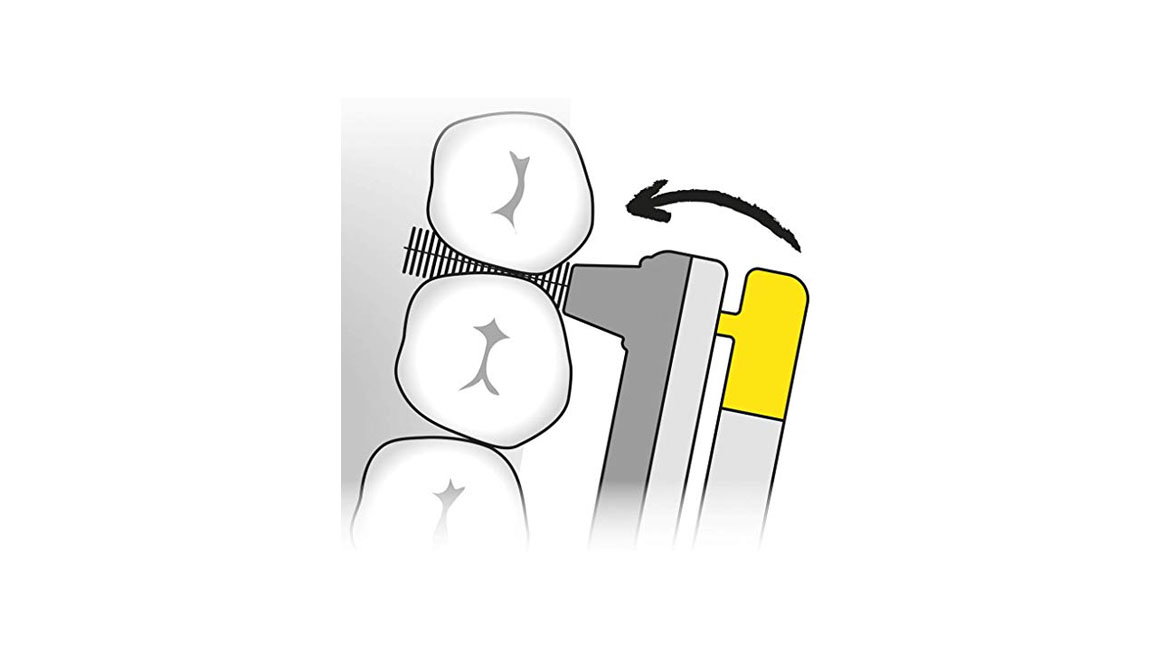 wingbrush