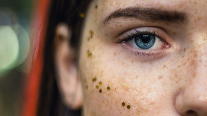 Face Mapping: Das verrät die Lage der Pickel im Gesicht über deine Gesundheit