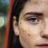 Face Mapping: Das verrät die Lage der Pickel im Gesicht über deine Gesundheit