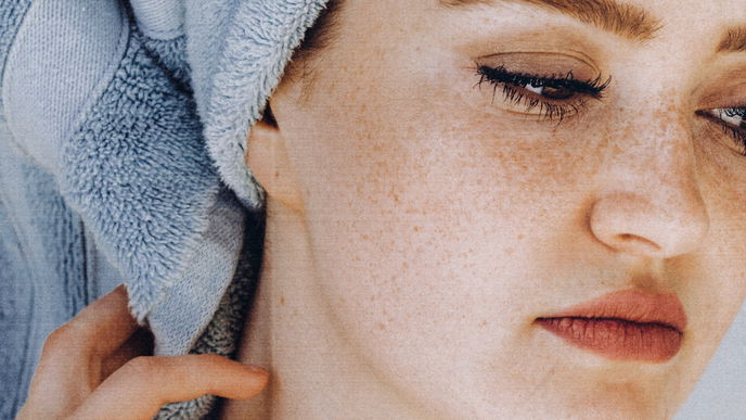 Helfen Kartoffeln gegen Akne? Wir haben den Beauty-Trend ausgecheckt