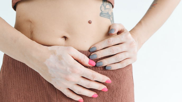 Was hilft gegen Narben? Tipps zur Behandlung