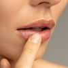 Hausmittel gegen Herpes: Bläschen schnell loswerden