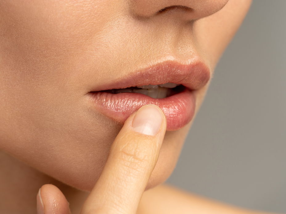 Frau mit Herpes an der Lippe