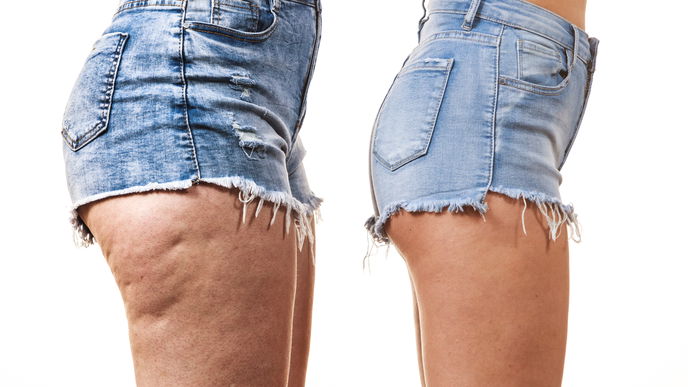 Instagram: So krass lügen Influencer*innen bei ihren Fotos