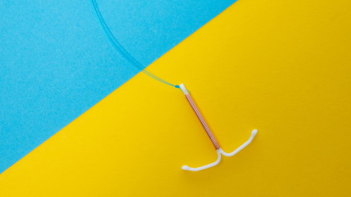 Kupferspirale: Das hormonfreie Verhütungsmittel im Check