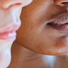 Sebaceous Filaments: Was ist das eigentlich und was hilft dagegen?