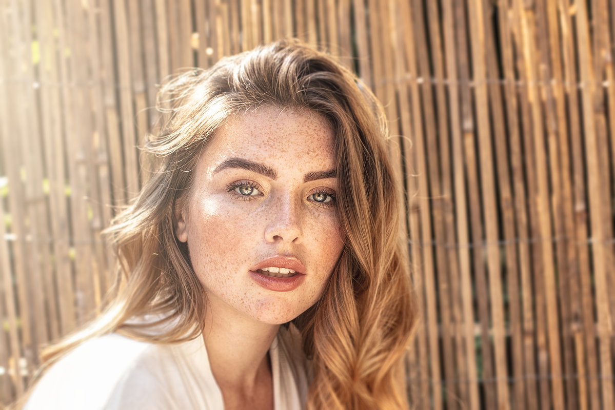 Frau mit Sommersprossen im Gesicht