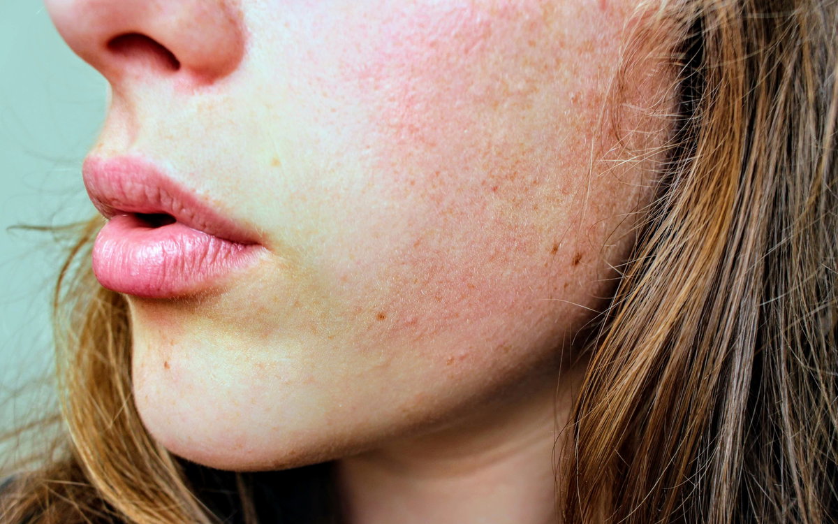 Gesicht und Lippen einer Frau