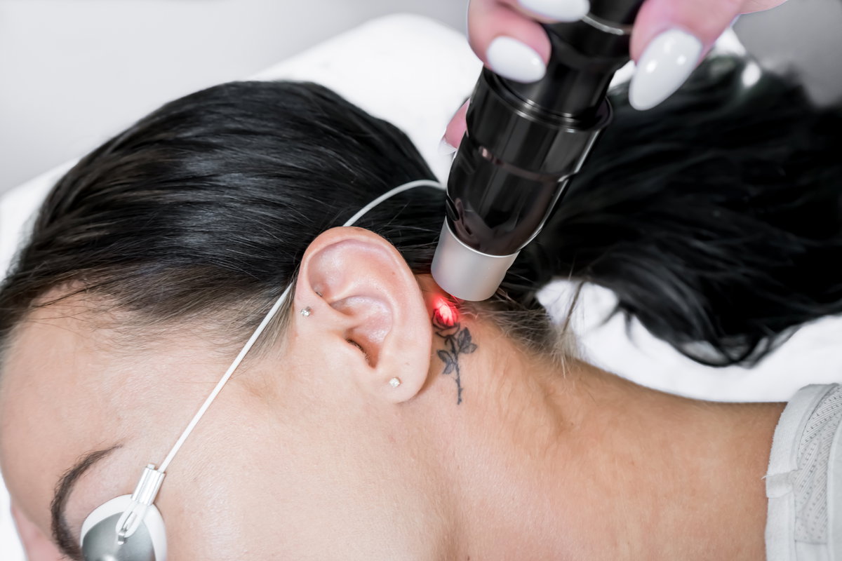 Tatto hinter dem Ohr wird gelasert
