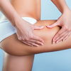 Cellulite entfernen: Mit diesen 6 Behandlungsmethoden reduzierst du die Orangenhaut
