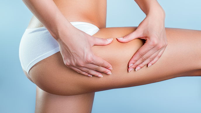 Cellulite entfernen: Mit diesen 6 Behandlungsmethoden reduzierst du die Orangenhaut