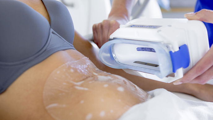 CoolSculpting: So verlierst du Fettpölsterchen durch Kälte
