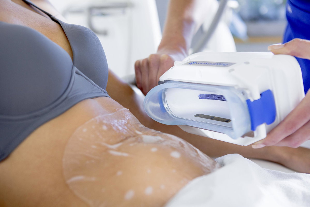 CoolSculpting Behandlung