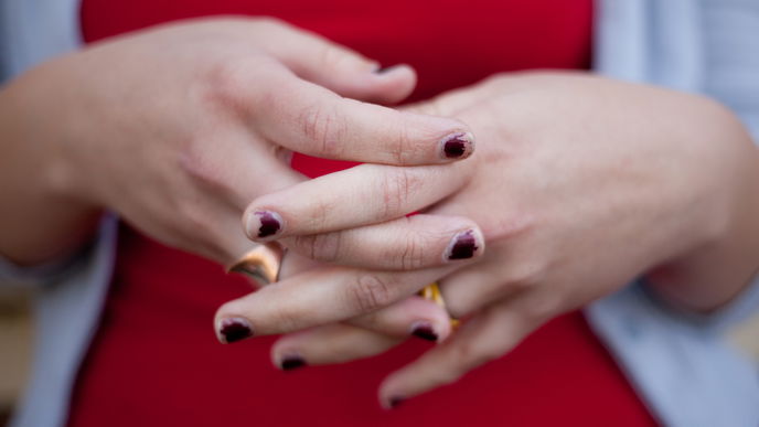 Nagellack blättert schnell ab: 3 Fehler, an denen es garantiert liegt