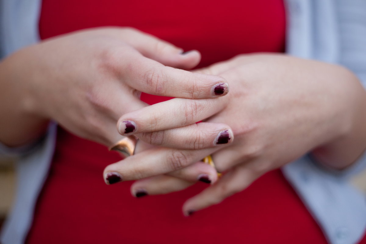Abgesplitterter Nagellack