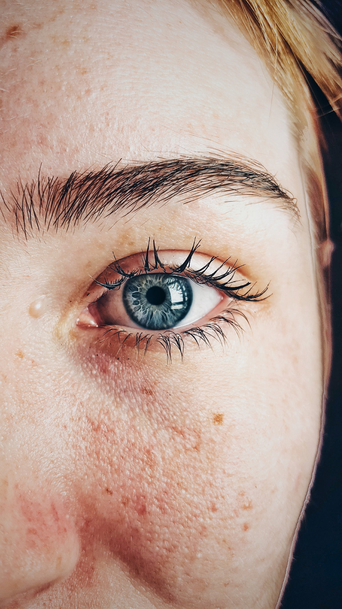 Müde Augen