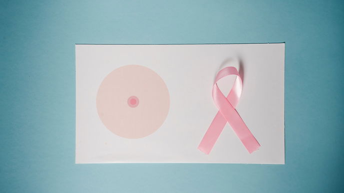 Brustkrebsmonat: "The Grace Project" – Frauen zeigen ihre Narben