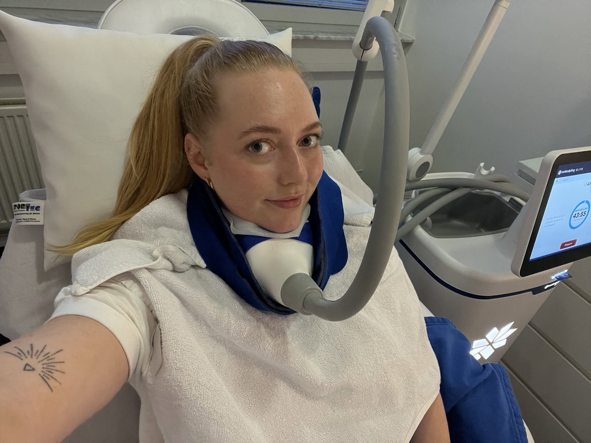 CoolSculpting am Doppelkinn