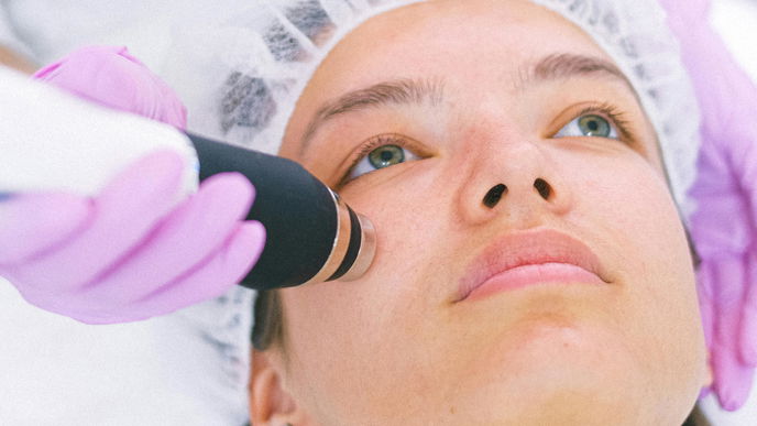 Hydradermabrasion: Alle Infos über die Gesichtsbehandlung