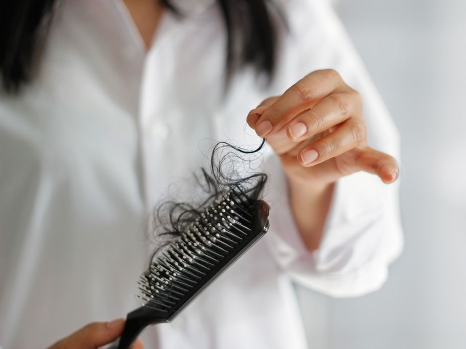 Eine Frau hält eine Bürste mit ihren ausgefallenen Haaren in der Hand