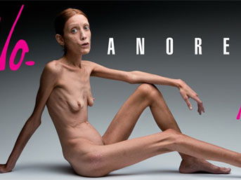 nolitas-aktuelle-kampagne-no-anorexia-www-nolita-it-520x257-9851.jpg