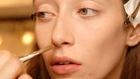Models mit Pickeln: Unreine Haut der Topmodels
