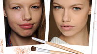 Unreine Haut und Herpes: So tricksen Models