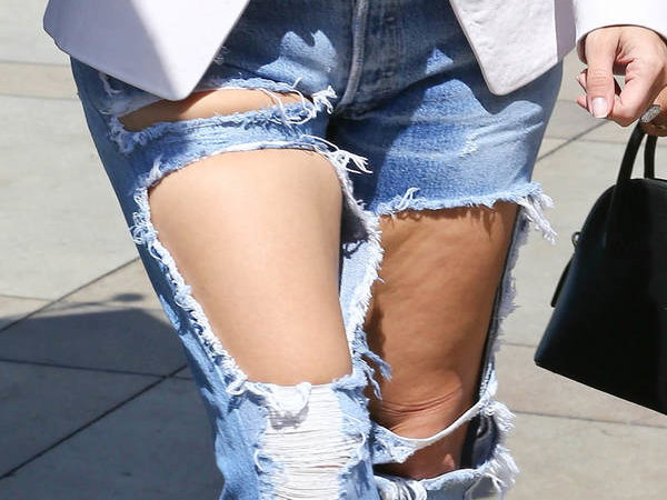 Stars mit Cellulite