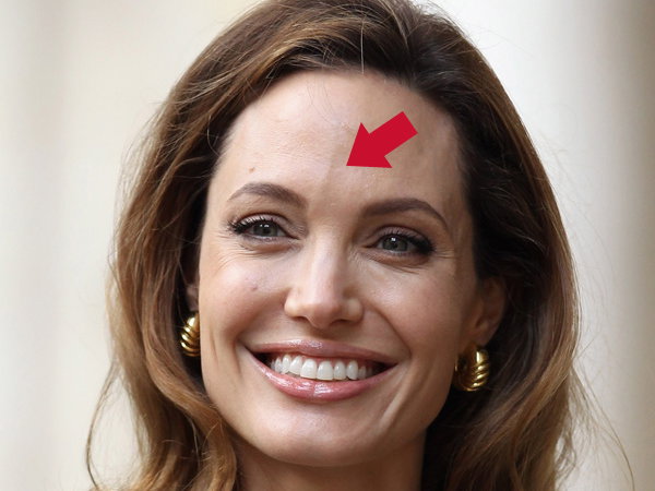 Angelina Jolies Stirn Vene