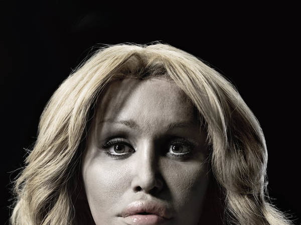 Botox und Co. schaffen "A New Kind of Beauty"