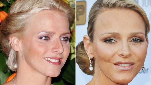 Charlene Wittstock - voher, nachher