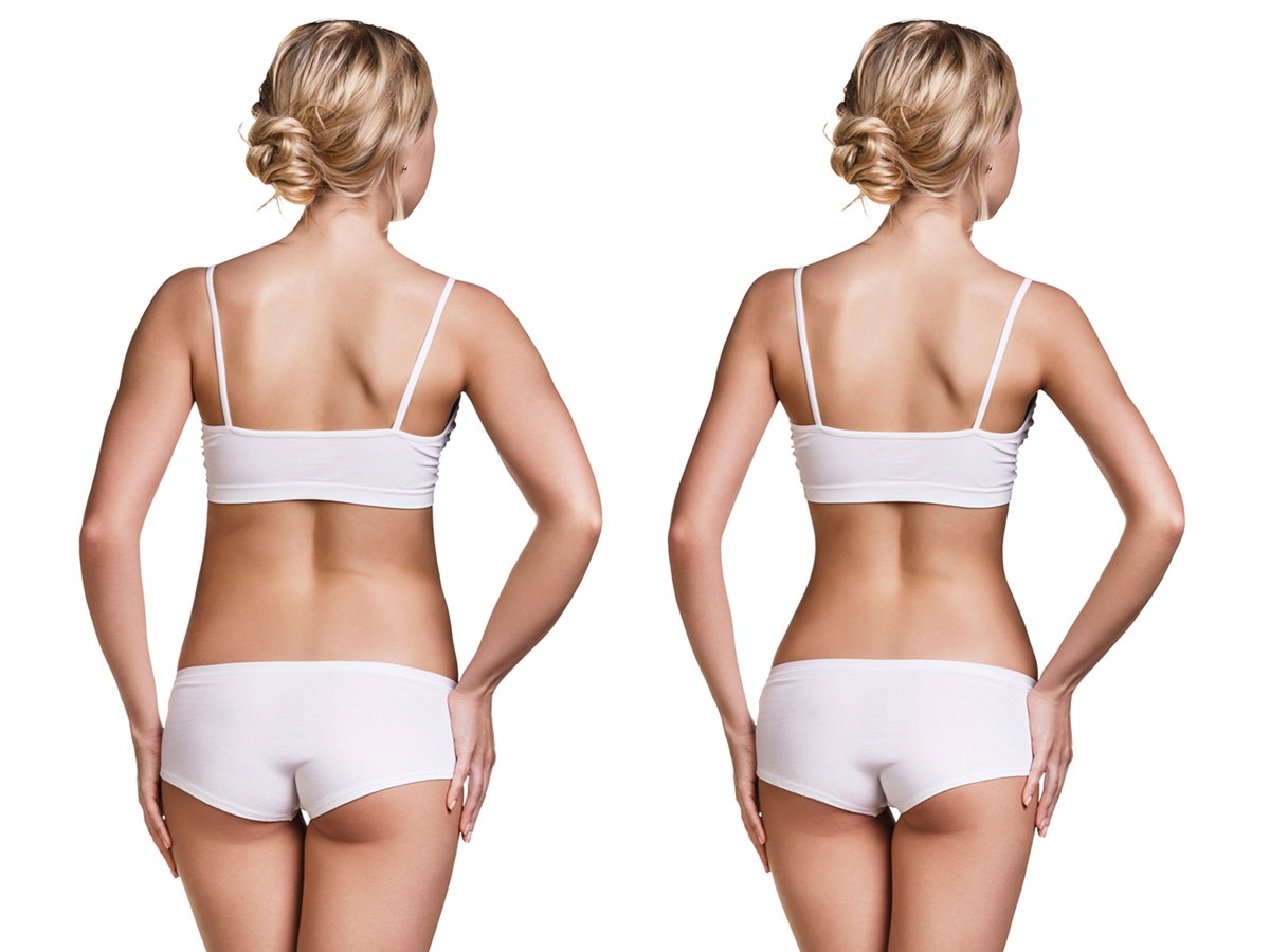 vorher-nachher-body