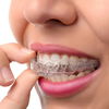 Invisalign - Die unsichtbare Zahnspange