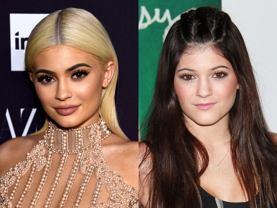 kylie jenner lippenfiller