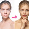 Blurring: Der Real-Life-Filter für eure Haut