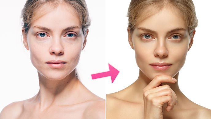 Blurring: Der Real-Life-Filter für eure Haut