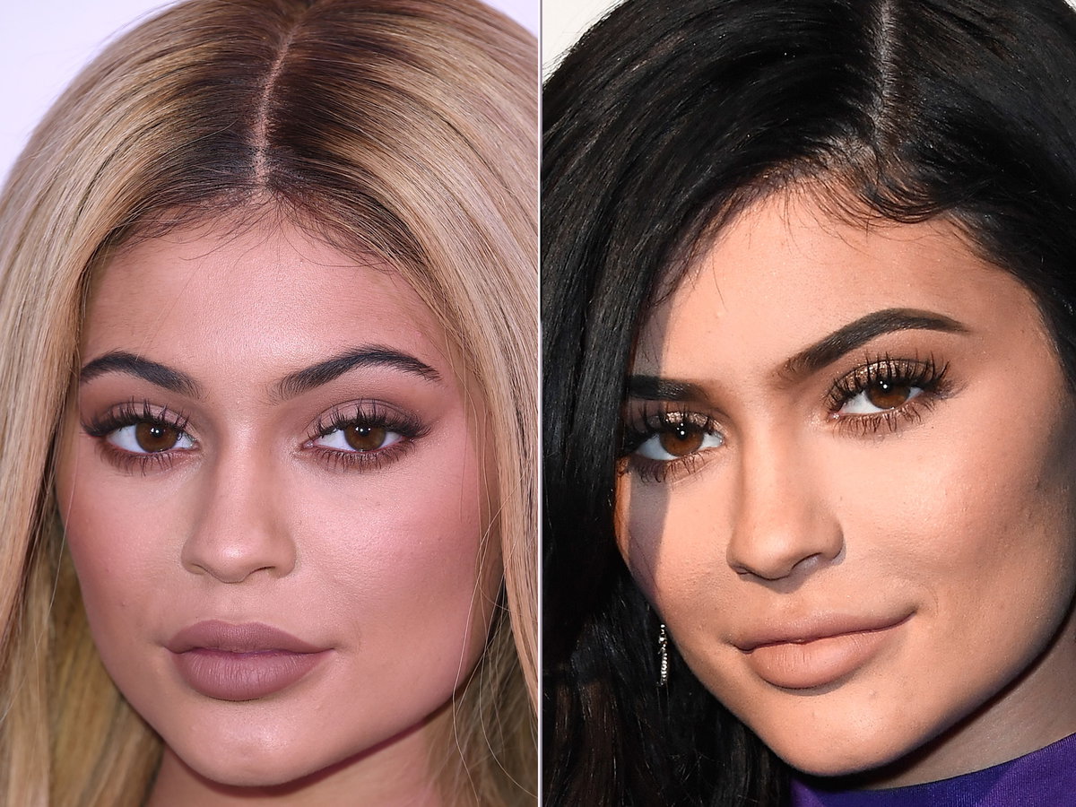 KYlie-Jenner-lippeninjektion