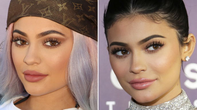 Kylie Jenners Lippen bei den Golden Globes
