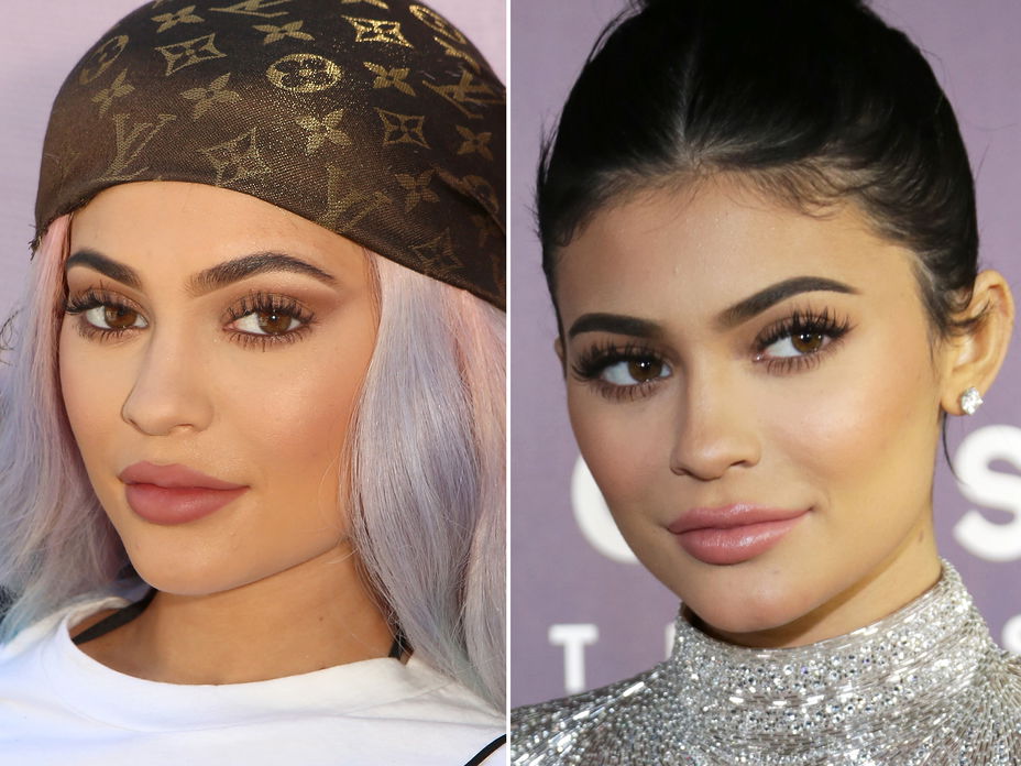 kylie-jenner-lippen-früher-heute