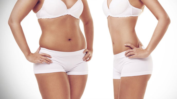 "Straight/Curve" ist die neue Body-Positive-Doku, auf die wir gewartet haben