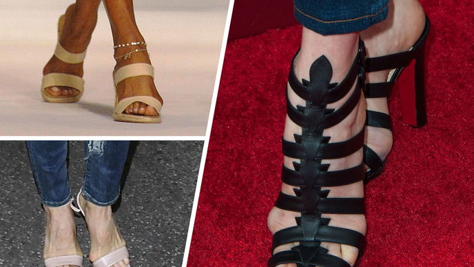 Hallux Valgus: Ursachen, Behandlung und betroffene Stars 